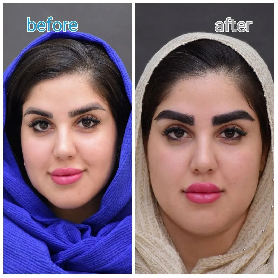 قبل و بعد کاشت ابرو روی تتو
