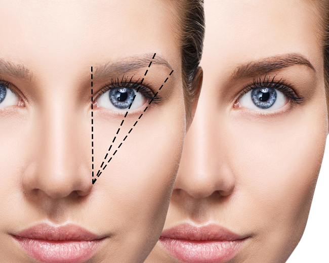 کاشت ابروی طبیعی در مشهد