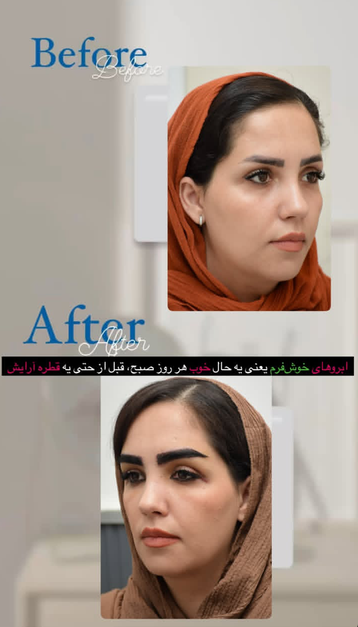 قبل و بعد کاشت ابرو روی تاتو 1