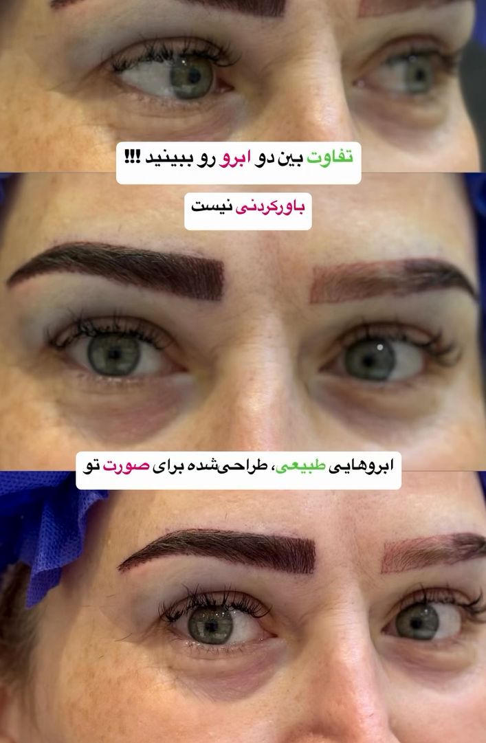 قبل و بعد کاشت ابرو روی تاتو 3