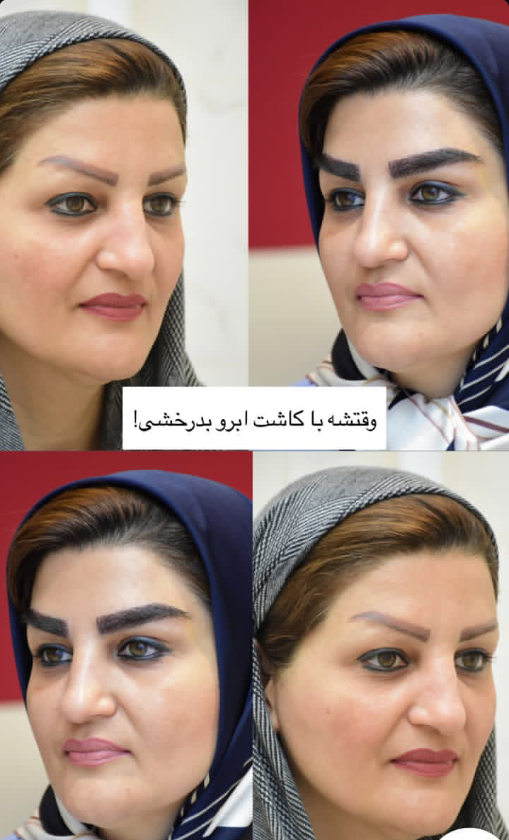 قبل و بعد کاشت ابرو روی تاتو