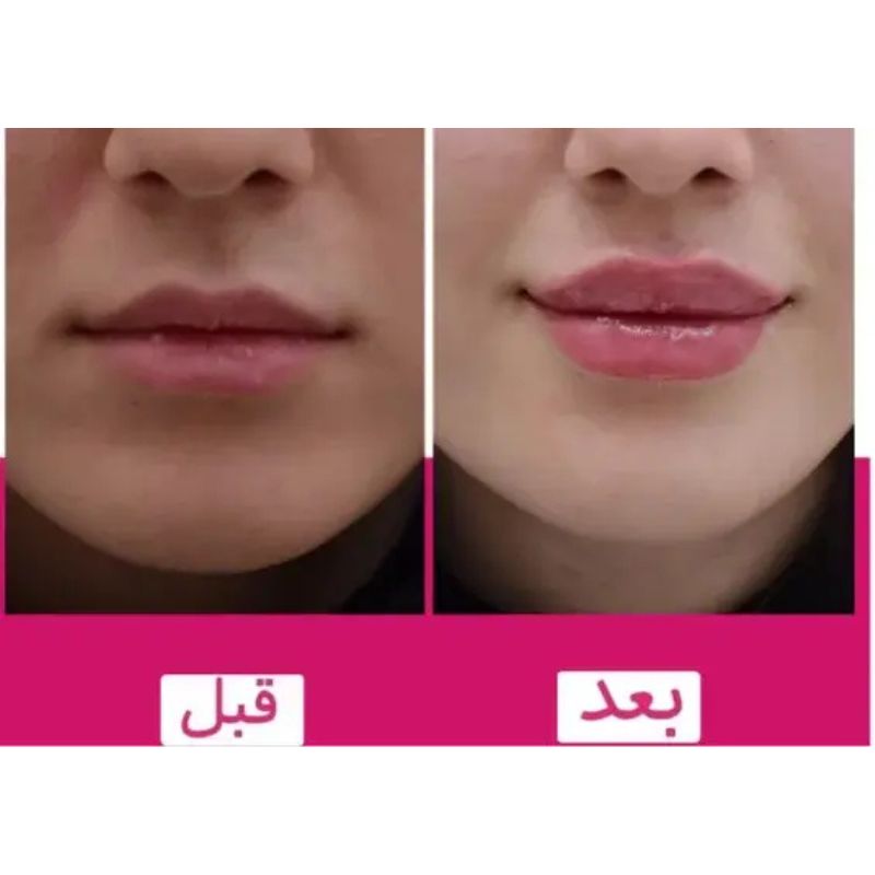 ژل لب